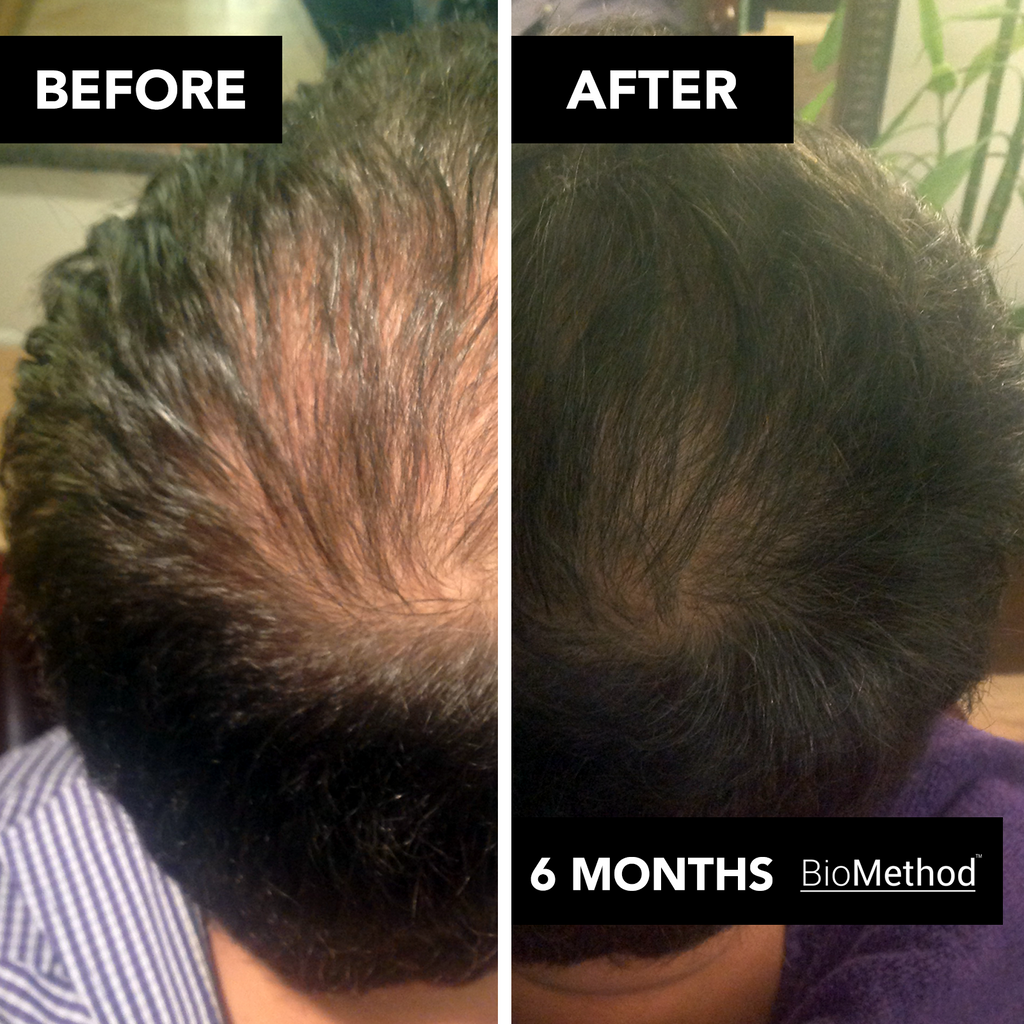 Énergisant Pro Cleanser for the Scalp