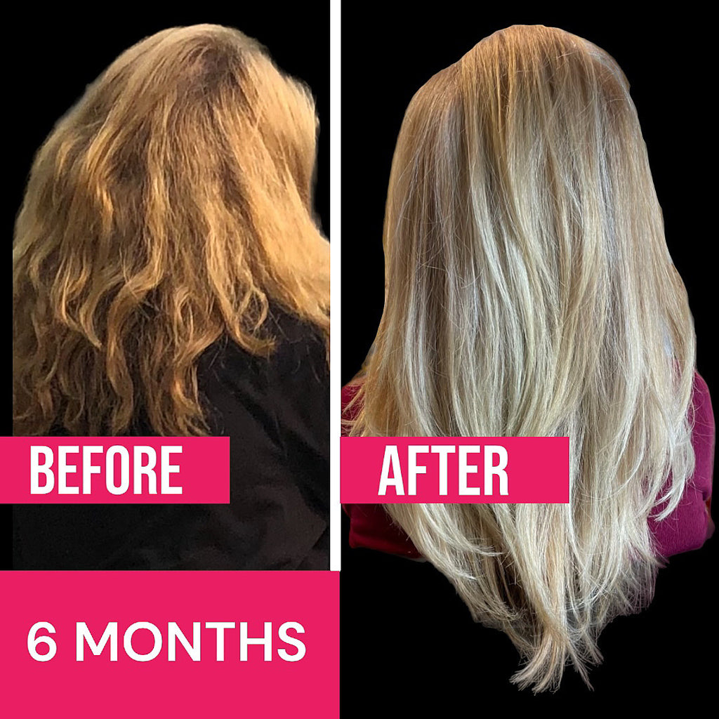 Vital Treatment - Ampoules for the Scalp (10)